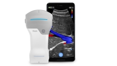 The Vscan Air with its smartphone app
