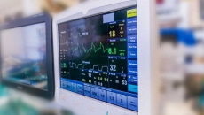 A heart monitor used during surgery