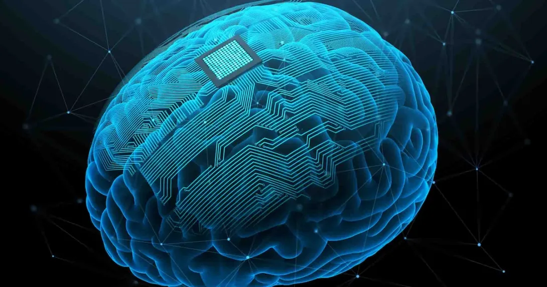 AI generated image of a brain implant on a brain