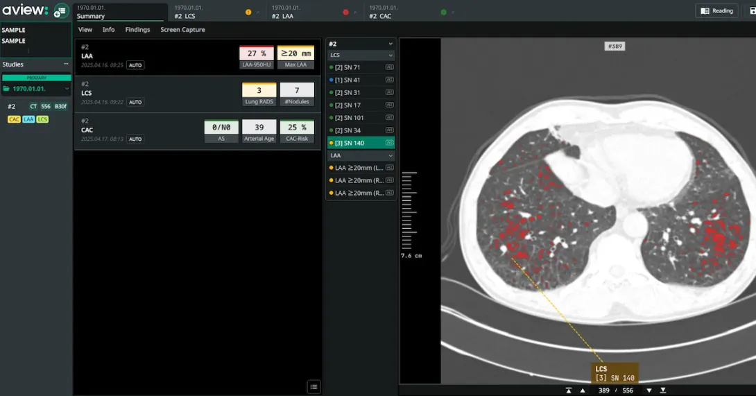 Interface of AVIEW LCS Plus desktop software