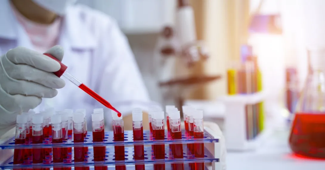 Laboratory worker working with blood tests