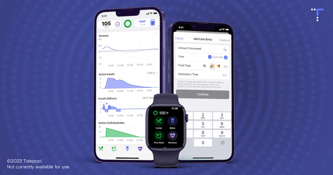 Tidepool Loop application on a phone Tidepool Loop application on a phone